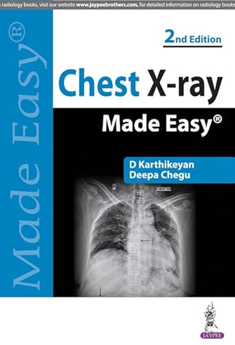 Chest X-Ray Made Easy