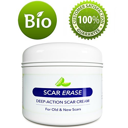 All Natural  Removal Cream for Face Legs & Body -  Cream for New s Old s & Stretch Marks - Anti Aging Cream for Men & For Women with Kokum Butter and Antioxidants  E - 4 Oz