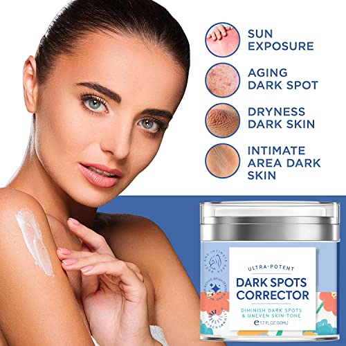 Lanmeri Dark Spot Corrector Cream, Dark Spot Remover For Body, Hyperpigmentation Treatment, Underarm, Neck, Armpit, Knees, Elbows, Private Areas, For Both Women And Men, For All Skin Types #TOP3