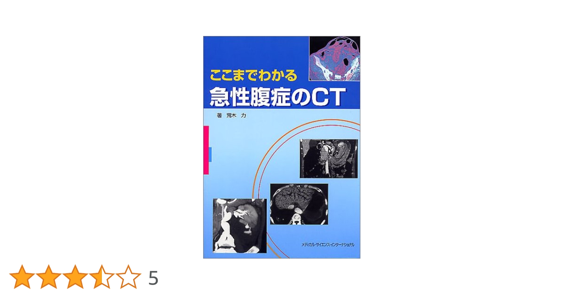 ここまでわかる急性腹症のCT 51MZZJLOE2L.jpg