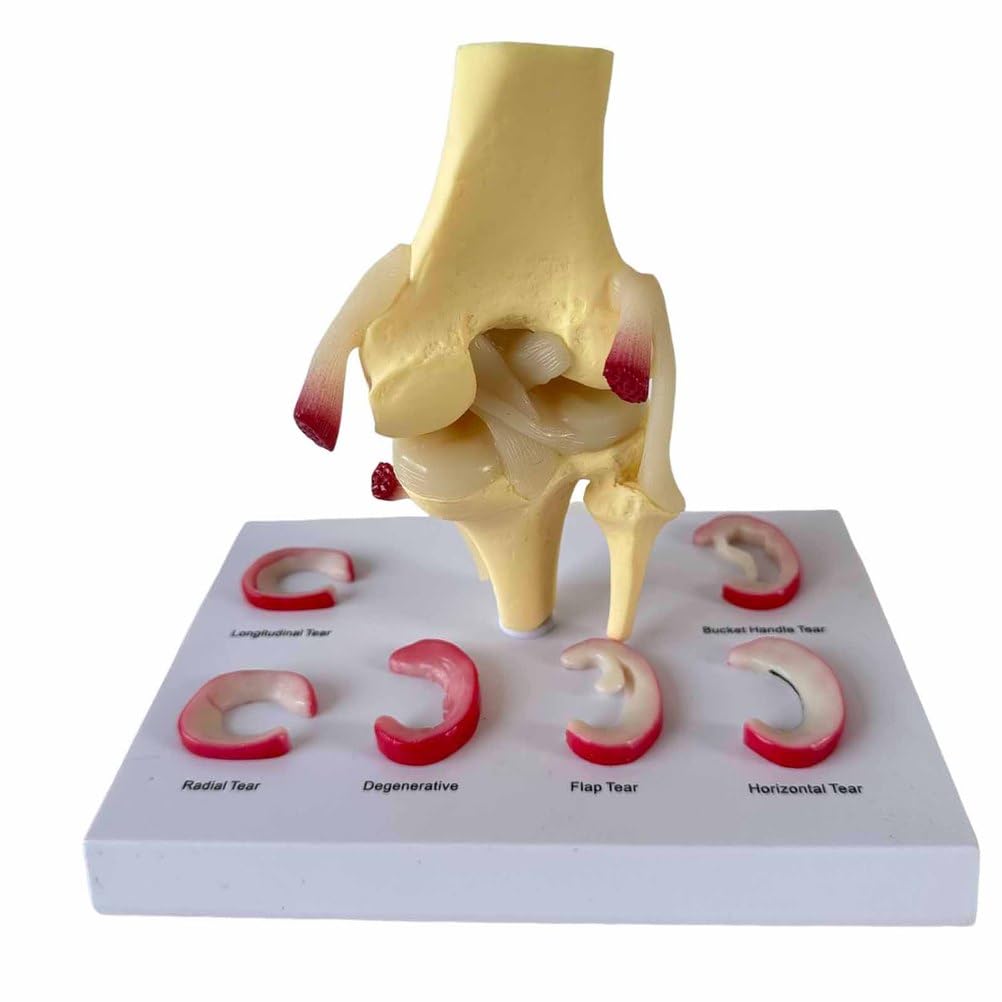 Modelo de articulación de Rodilla Humana Modelo de lesión de menisco Modelo de reparación de ligamento de Rodilla