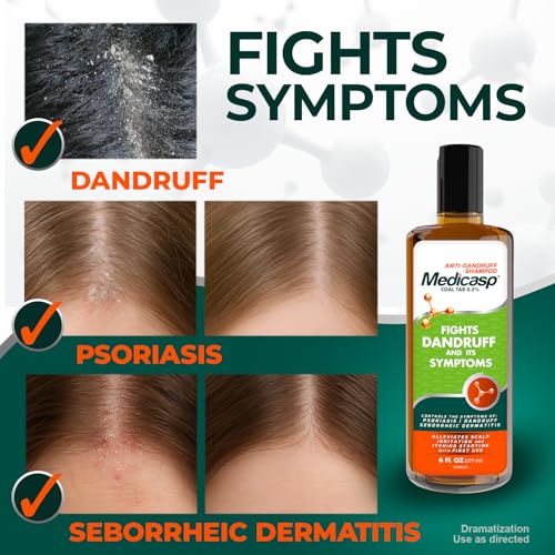 Medicasp Coal Tar Anti-Dandruff Shampoo, Alleviates Symptoms from 1st Wash, Treats Psoriasis, Seborrheic Dermatitis & Itchy Dry Scalp, Fights the Root Cause of Dandruff, Flakes Shampoo, 6 fl oz