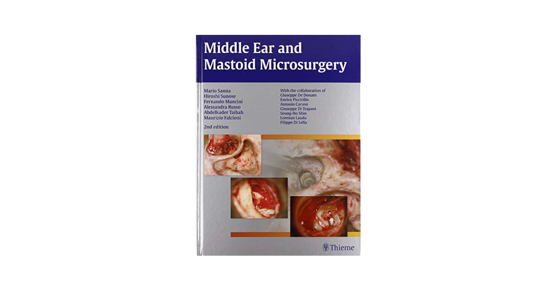 健康・医学 Atlas of Microsurgery of the Lateral S.. Middle Ear and Mastoid Microsurgery: 9783131320926: Medicine