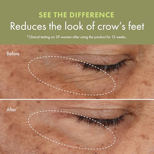 Origins Plantscription™ Wrinkle Correction Eye Cream With Encapsulated Retinol Crema Idratante E Lisciante Occhi Con Retinolo 15 Ml - 6