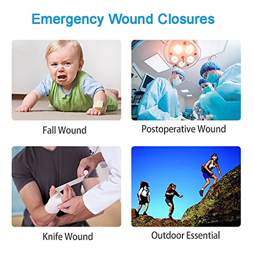 Longmed Emergency Wound Closures - 3 Pcs Butterfly Bandages Adhesive Bandages Stitch Sutures Zipper Laceration Repair Without Stitches For Wound Care First Aid #TOP1