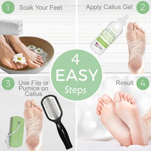image for EntreFeet Dr. Entre's Callus Remover Gel Kit for Feet: Foot File, Pumi