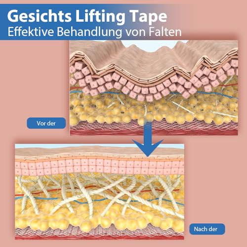 Face Lifting Tape - SFUCHIN 2.5CM*500CM Multifunktion Anti Falten Face Tape - Zornesfalte Pflaster - High Elastic Kinesiology Facial Stirn Augen Lippen Wrinkle Patches - Doppelkinn Entferner - 2 Rolls