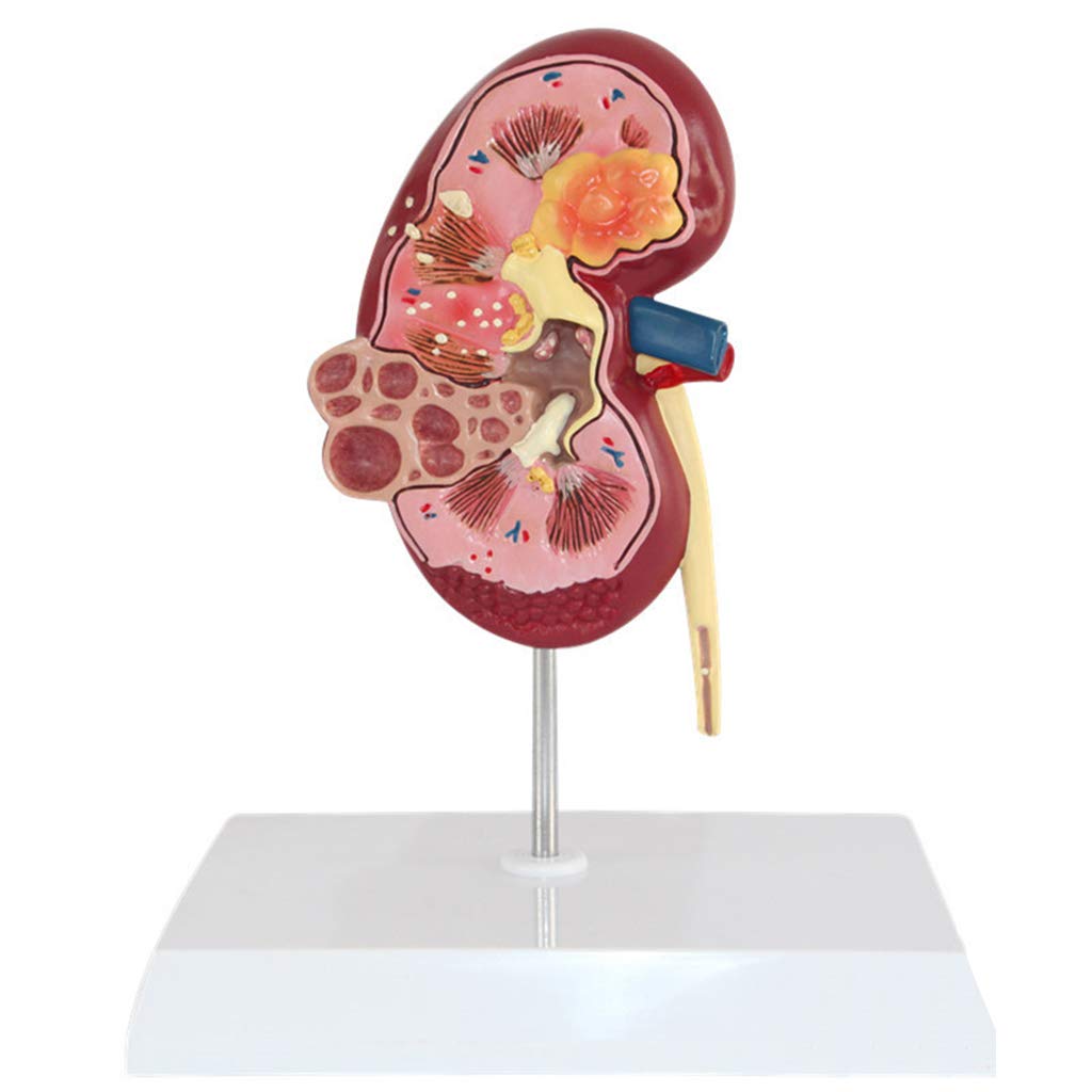 Sjdopulse Human Kidney Anatomical Model - Medical Anatomical Kidney Model - Human Organ Medical Anatomy Model - For Medical School Student Training Aid
