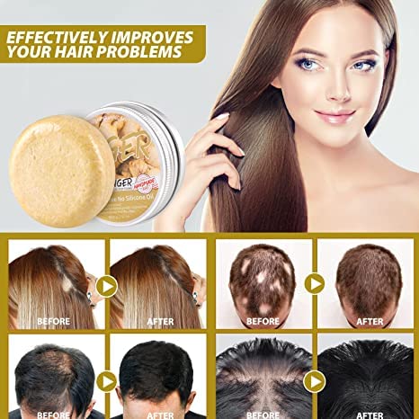 Foto von Jesshiny 2Stück Ginger Hair Regrowth Shampoo Bar,Ingwer-Haarwuchs-Shampoo-Riegel,Solid Shampoo Bar,Shampoo Gegen Haarausfall, fördert Gesundes Haarwachstum