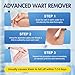 Bighero Wartss Corn Remover Maximum Strength Liquid with Salicylic Acid - Fast-Acting Wartsss Liquid Freeze Off Designed for Wartss, Plantar Wartss, Common Wartis, Flat Corn, Callus