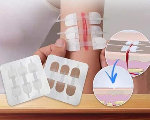 Miniatura 5 de Vendajes adhesivos de emergencia para heridas, calcomanías de puntada con cremallera para camping, supervivencia y equipo doméstico, 3 piezas (2.77