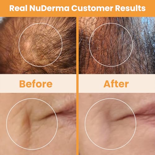 Pure Daily Care NuDerma Neon Skin Therapy Wand