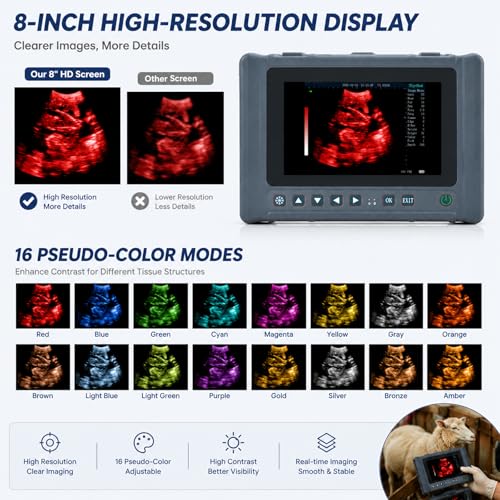 ultrasound machine 2026 29