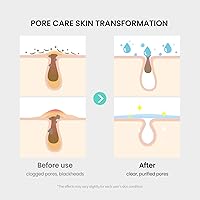 Vista 6 de coxir AHA + BHA - Tónico limpiador de poros para todo tipo de piel, purificante, AHA, BHA, cuidado diario de los poros, cuidado de la piel k Beauty