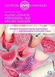 Plastic-Esthetic Periodontal and Implant Surgery, Volume 6: Horizontal Papilla Augmentation with Autologous Connective Tissue