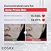 COSRX 15% Niacinamide Face Serum, 0.67 fl oz, Pore Minimizer Serum for Face, Even Skin Tone, Korean Skin Care