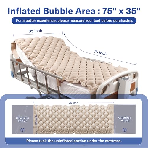 Alternating Pressure Mattress by Alcedo Health