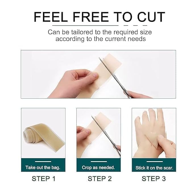 EXIFYLL Silicone Scar Sheets Tape Roll 1.5M | Reusable Silicone Strips for Scar Care | Surgical, C-Section, Tummy Tuck, Keloid & Acne Scars | Skin-Friendly (A1) (SKIN TONE) 2