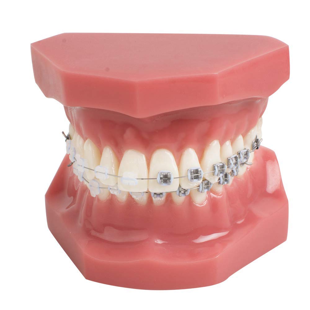 WJH Demonstracja modelu zębów dentystycznych model ortodontyczny zęby uczyć narzędzia do nauki z metalowym i ceramicznym uchwytem, czerwony