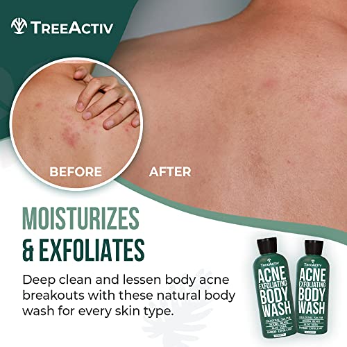 Treeactiv Acne Exfoliating Body Wash - Exfoliating Body Acne Wash For Back, Chest, Shoulder, And Butt Acne Removal - Back Acne Treatment For Women And Men - Back Acne Body Wash With Tea Tree Oil #TOP2