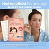 MEDca Acne Patches for Face - Hydrocolloid Bandages (36 Count) Pimple Patches for Face in 2 Universal Sizes, Acne Spot Treatment Care for Face & Skin Spot Patch Conceals Zits, Acne and Blackheads