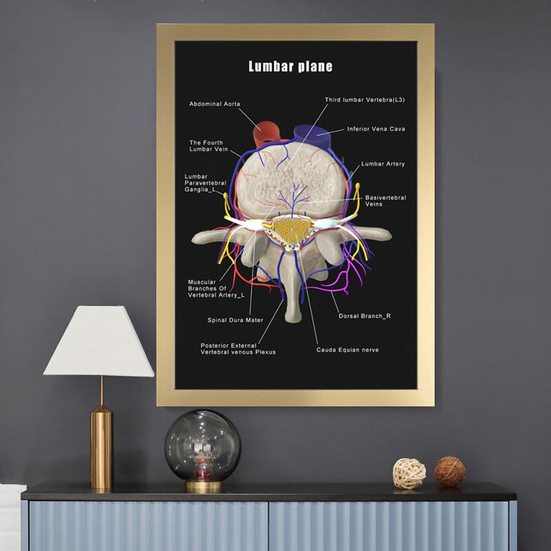 Image of Taanfu Body Educational Learning Anatomy Posters ，Lumbar Plane Art Lumbar Villi Anatomy Art Poster Digestive System Organs Illustration Small Intestine Physiology Anatomy Wall Art Villi