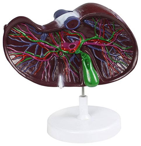 Image of B10459 Plastic Liver Model with Network of Vessels