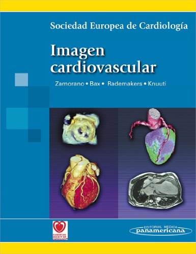 SEC-ZAMORANO:Imagen Cardiovascular SEC-ZAMORANO:Imagen Cardiovascular