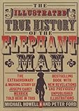True History Of The Elephant Man