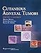 Cutaneous Adnexal Tumors