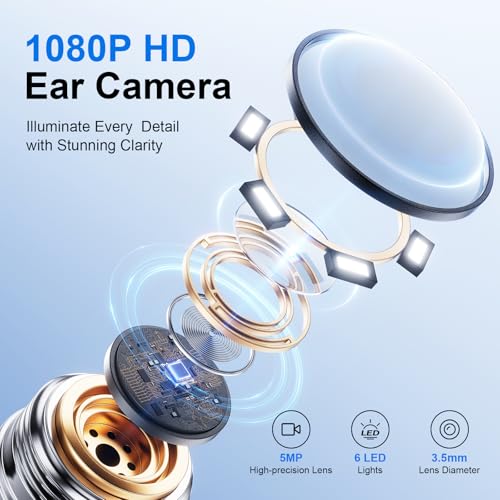 Image of Oxbird(200-300W-PX) HD Wireless Otoscope with Light Ear Wax Camera, Ear Wax Remover Removal Cleaner Cleaning Kit, Suitable for Apple /Android, Dad and Madam Artifact,Perpetual Commitment