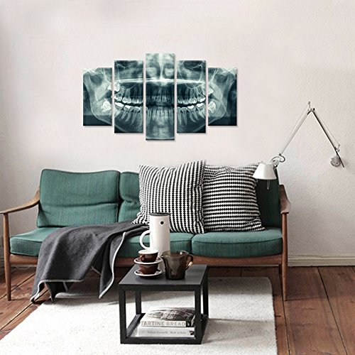 Ihappywall Modern 5 Panel Canvas Wall Art X-Ray Dental Tooth Oral Panoramic The Picture Teeth Decay Print For Dental Room Stretched And Framed For Living Room Ready To Hang #TOP1