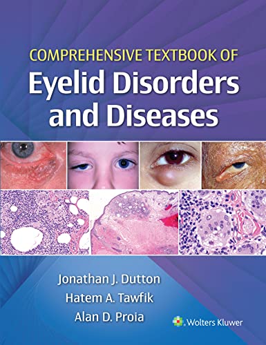Comprehensive Textbook of Eyelid Disorders and Diseases