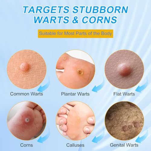 ZGjoib WART Corn Remover Pads for Feet, 40% Salicylic Acid Wart Remover Pads, WART Corn Removers for Toes,Body（NDC Code: 85248-065-01） — view 3
