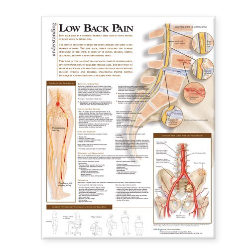 Understanding Low Back Pain Anatomical Chart [Paperback] [2008] (Author) Anatomical Chart Company      Paperback – January 1, 2008