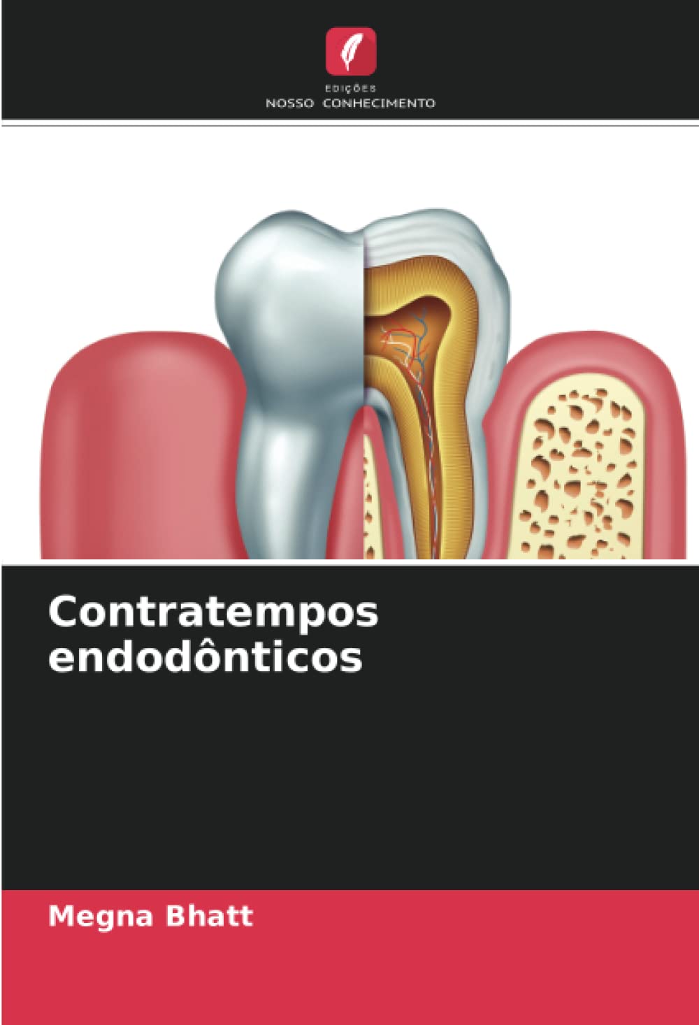 Contratempos endodônticos
