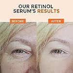 Retinol Serum for Face 2.5%, B5 Resurfacing Retinol Serum with Vitamin C, Vitamin E, Hyaluronic Acid, Niacinamide, Peptide for Anti-Aging, Wrinkle Smoothing, Dark Spot Corrector, Brighten Dullness - Image 5