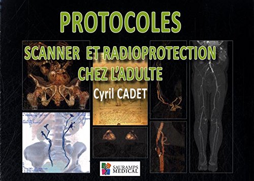Protocoles scanner et radioprotection chez l'adulte Protocoles scanner et radioprotection chez l'adulte