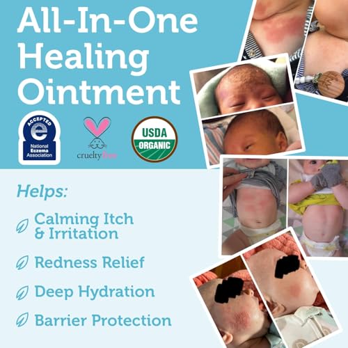 Image of Era Organics Healing Ointment for Babies - USDA Certified Organic Natural Moisturizer Gentle on Sensitive Skin Prone To Baby Eczema, Cradle Cap (Infant Seborrheic Dermatitis), Rashes, Hives 4oz