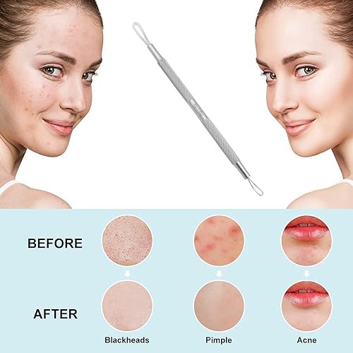 Miniatura 2 de Removedor de puntos negros, removedor de espinillas, extractor de comedia, herramienta para el acné, Komedon de doble cara, suave al tacto y