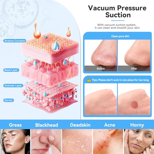 Upgraded Diamond Micro-Dermabrasion Machine
