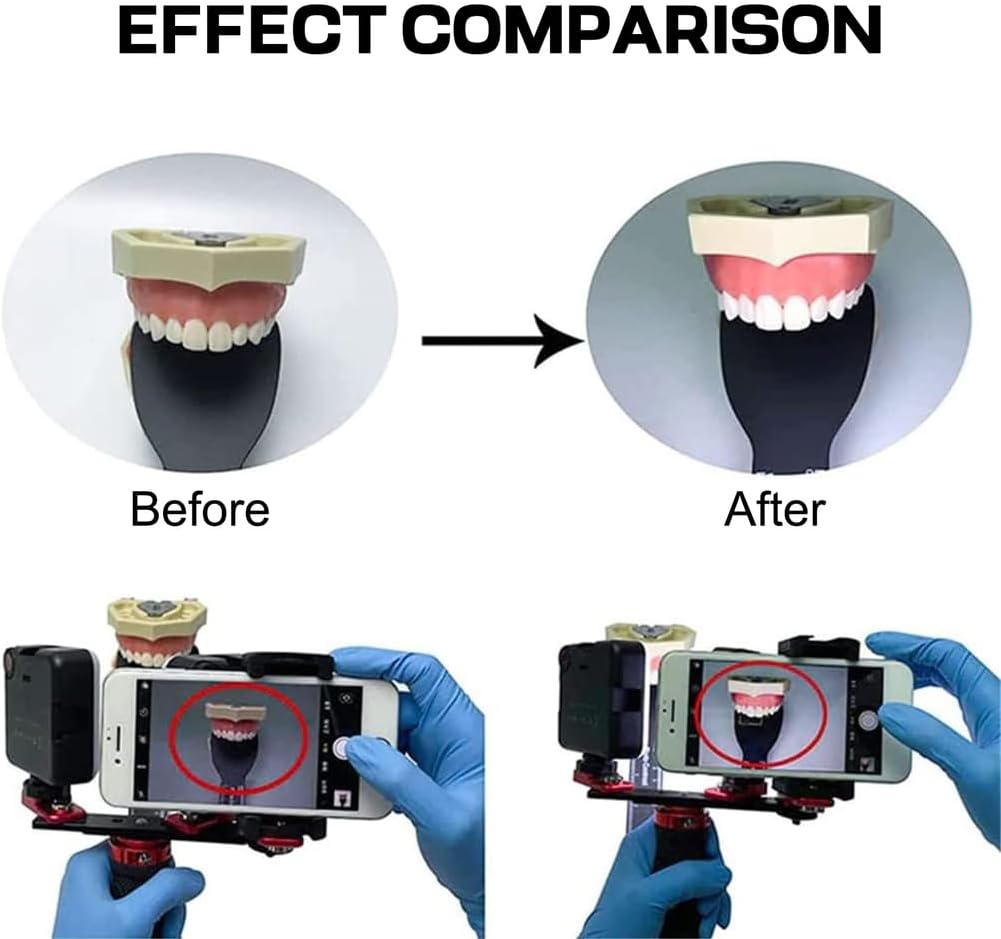 Dental Fill Light Flash Photography Kit Professional Aid Oral Camera Photo Video Flashlight Teeth Photography Tool for Dentistry (3000-6000K)