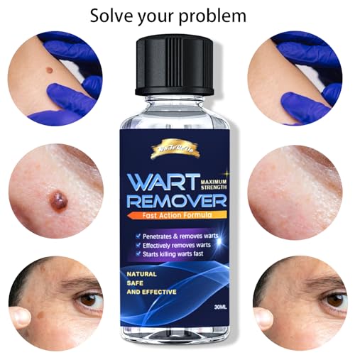 Strongest Wart Corn Remover Mask for Toes Fingers: Foot Wart Corn Removal for Feet Hands - Exclusive Formula Salicylic Acid Wart Off Mask for Plantar Wart, Flat Wart for You - 1 Oz 2 PCS
