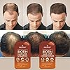 Hair-Growth-Shampoo-Conditioner-Set-An-Anti-Hair-Loss-Biotin-Shampoo-and-Conditioner-with-14-DHT-blockers-to-fight-Hair-Loss-For-Men-and-Women-All-Hair-types-Sulfate-Free-2-x-16-fl-oz First Botany, Hair Growth Shampoo Conditioner Set - An Anti Hair Loss Biotin Shampoo & Conditioner with DHT blockers to fight Hair Loss For Men & Women, All Hair types, Sulfate Free - 2 x 16 fl oz