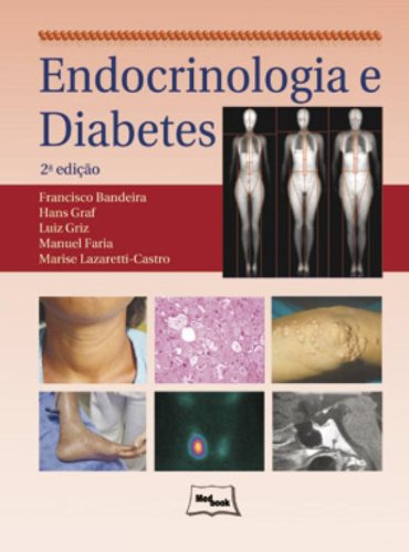Endocrinologia e Diabetes