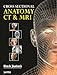 Cross Sectional Anatomy CT & MRI