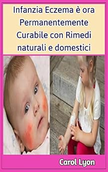 trattamento dell'eczema per gli uomini