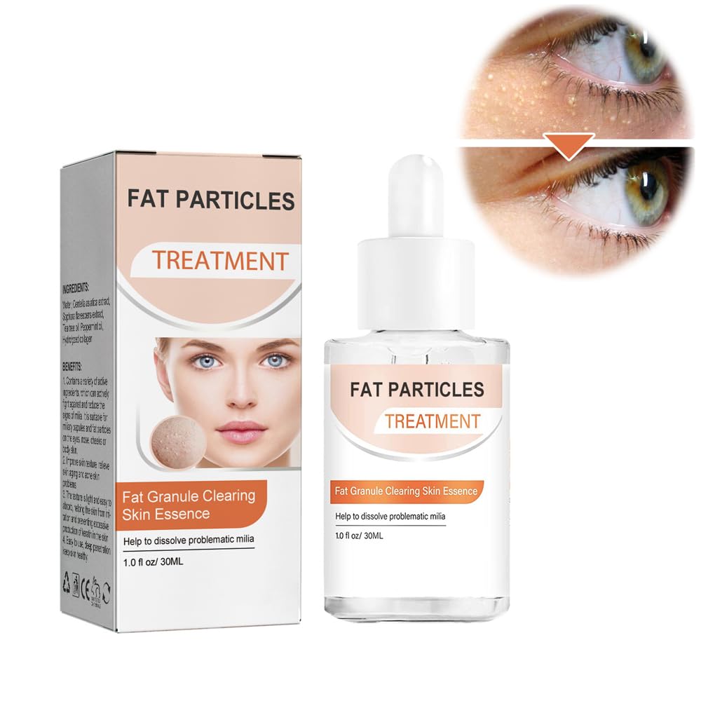 AzoneeMilia Clearing Essence, Milia Remover Serum, Organic Skin Spot Purifying Serum, Milia Spot Removal Treatment for All Skin Types