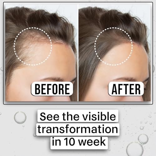 Image of KAZIMA Advanced Hair Growth Serum | 3% Redensyl, 4% Anagain, 2% Procapil, 2% Lindera Strychnifolia, Rosemary & Black Rice Extract | Hair Growth & Hair Fall Control Serum | Boosts Hair Density | 30 ml