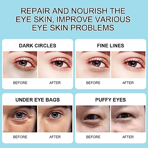 Rouse Snail Extract Collagen Under Eye Patches With Hyaluronic Acid Anti-Aging Eye Mask Under Eye Bags Dark Circle Removal Moisturizing Repairing Friming Eye Gel Treatment Mask-60Pcs #TOP3